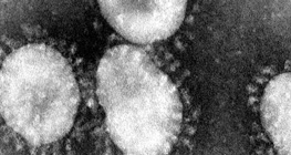proteksi-diri-dari-virus-corona:-mengikuti-himbauan-pemerintah